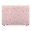 Macbook Premium Case - Baby