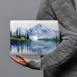 hardshell case with Watercolor View design combines a sleek hardshell design with vibrant colors for stylish protection against scratches, dents, and bumps for your Macbook