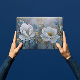 personalized microsoft surface case with Flower Art design